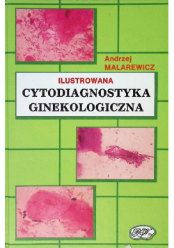 Cytodiagnostyka ginekologiczna