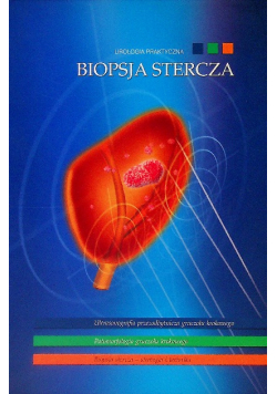 Urologia praktyczna biopsja stercza