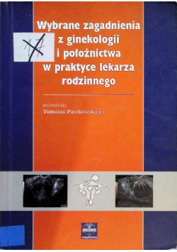 Wybrane zagadnienia z ginekologii i położnictwa w praktyce lekarza rodzinnego