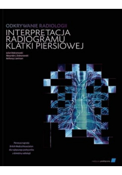 Odkrywanie radiologii: interpretacja radiogramu klatki piersiowej