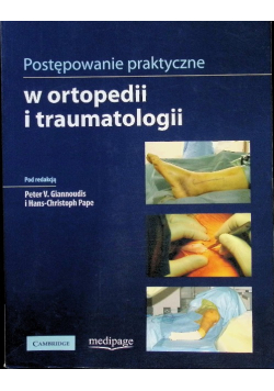 Postępowanie praktyczne w ortopedii i traumatologii