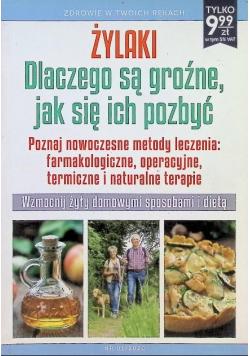 Żylaki. Dlaczego są groźne, jak się ich pozbyć
