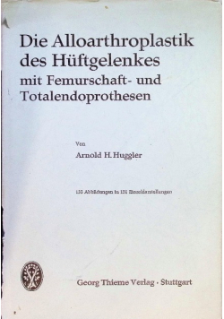 Die Alloarthroplastik des Huftgelenkes mit Femurschaft- und Totalendoprothesen