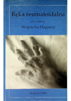 Ręka reumatoidalna