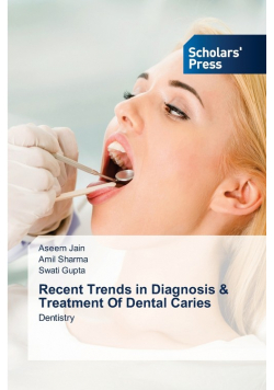 Recent Trends in Diagnosis & Treatment Of Dental Caries