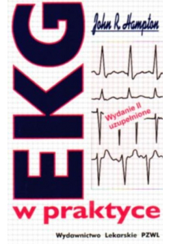 EKG w praktyce