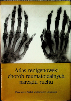 Atlas rentgenowski chorób reumatoidalnych narządu ruchu