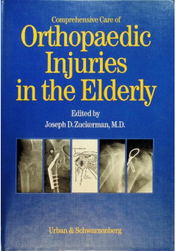 Comprehensive Care of Orthopaedic Injuries in the Elderly
