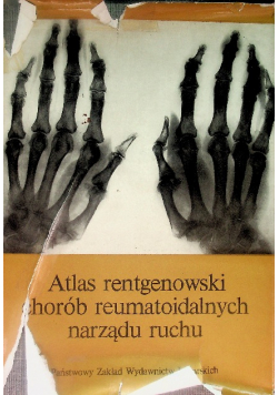 Atlas rentgenowski chorób reumatoidalnych narządu ruchu