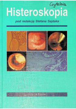 Histeroskopia