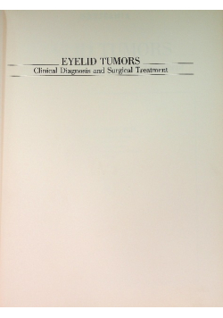 Eyelid tumors Clinical Diagnosis and Surgical Treatment