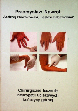Chirurgiczne leczenie neuropatii uciskowych kończyny górnej