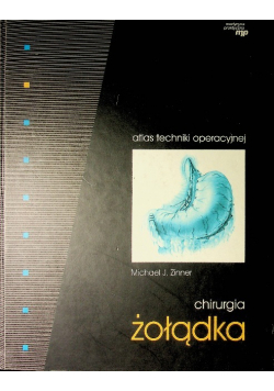Chirurgia Żołądka