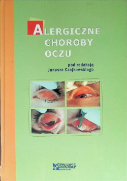 Alergiczne choroby oczu