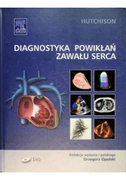 Diagnostyka powikłań zawału serca