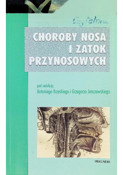 Choroby nosa i zatok przynosowych