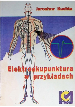 Elektroakupunktura w przykładach