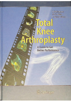 Total Knee Arthroplasty: A Guide to Get Better Performance