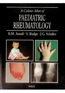 A Colour Atlas of Paediatric Rheumatology