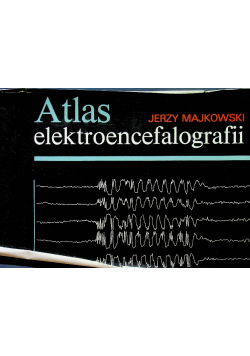 Atlas elektroencefalografii