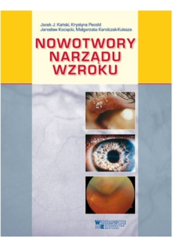 Nowotwory narządu wzroku