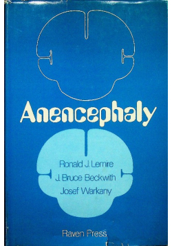 Anencephaly