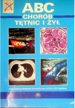 ABC chorób tętnic i żył