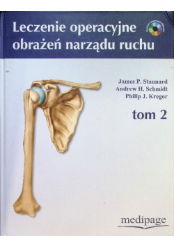 Leczenie operacyjne narządu ruchu Tom 2