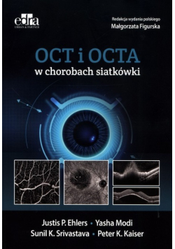 OCT i OCTA w chorobach siatkówki