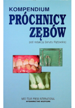 Próchnica zębów Kompendium