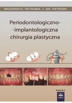Periodontologiczno implantologiczna chirurgia plastyczna