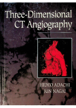 Three-Dimensional CT Angiography