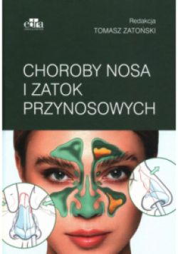 Choroby nosa i zatok przynosowych