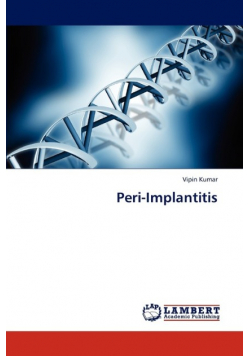 Peri-Implantitis