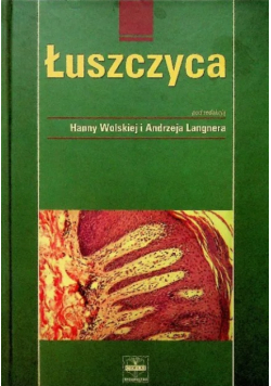 Łuszczyca