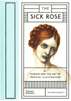 The Sick Rose