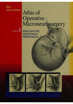 Atlas Of Operative Microneurosurgery Volume 1