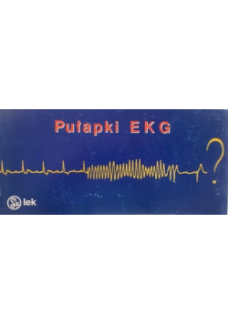 Pułapki EKG