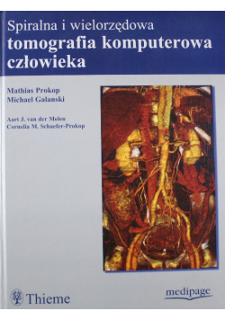 Spiralna i wielorzędowa tomografia komputerowa człowieka