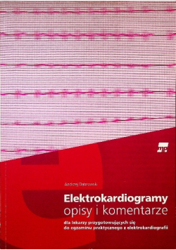 Elektrokardiogramy opisy i komentarze