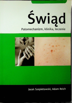 Świąd Patomechanizm klinika leczenie