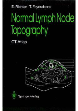 Normal lymph node topography CT - Atlas