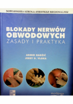 Blokady nerwów obwodowych