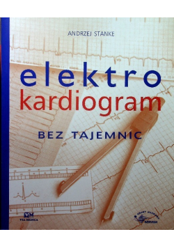 Elektrokardiogram bez tajemnic