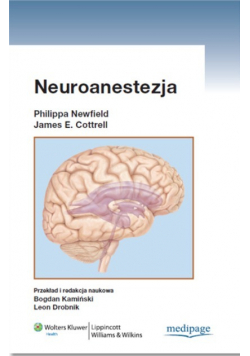 Neuroanestezja