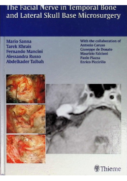 The Facial Nerve in Temporal Bone and Lateral Skull Base Microsurgery