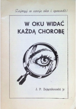 W oku widać każdą chorobę