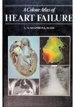 A Colour Atlas of Heart Failure