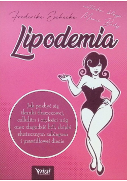 Lipodemia