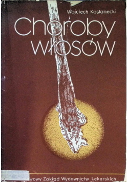 Choroby włosów